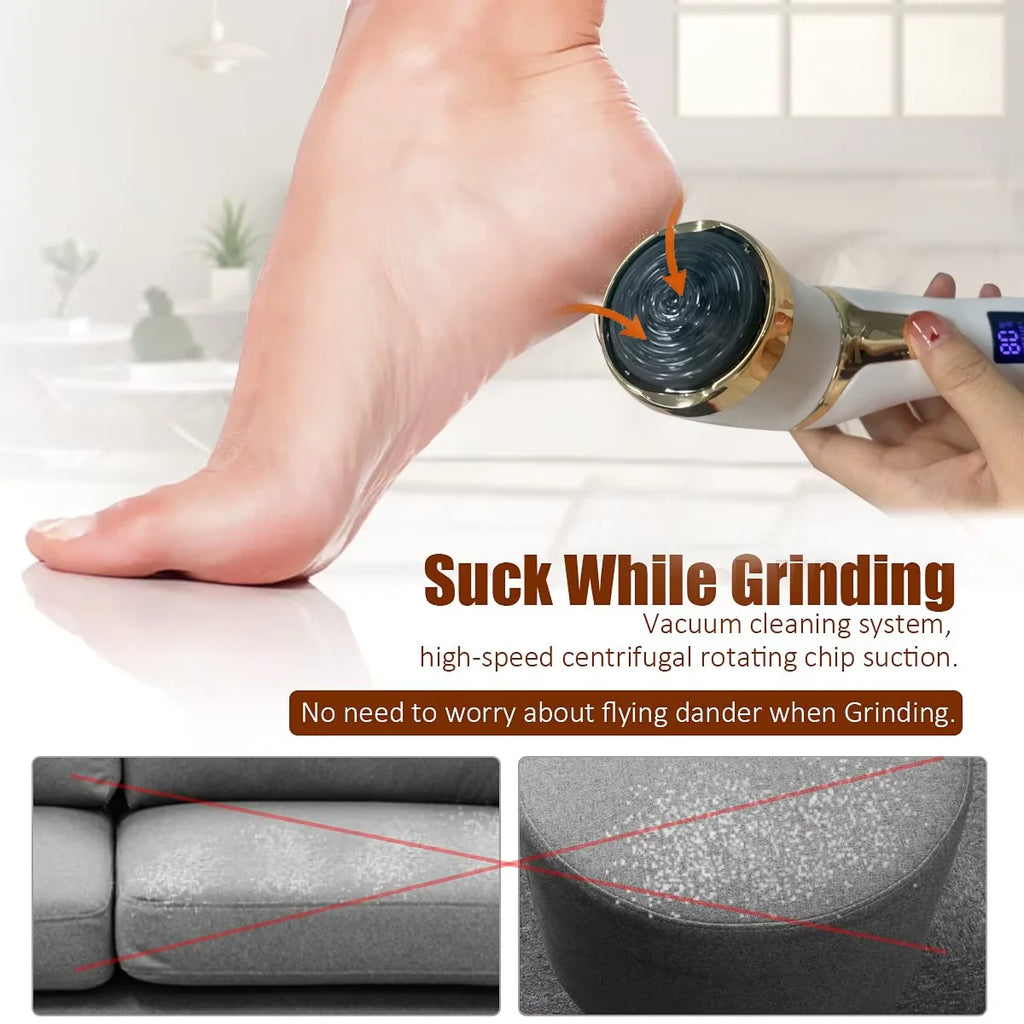 SoftStep Pro® – Electric Foot File