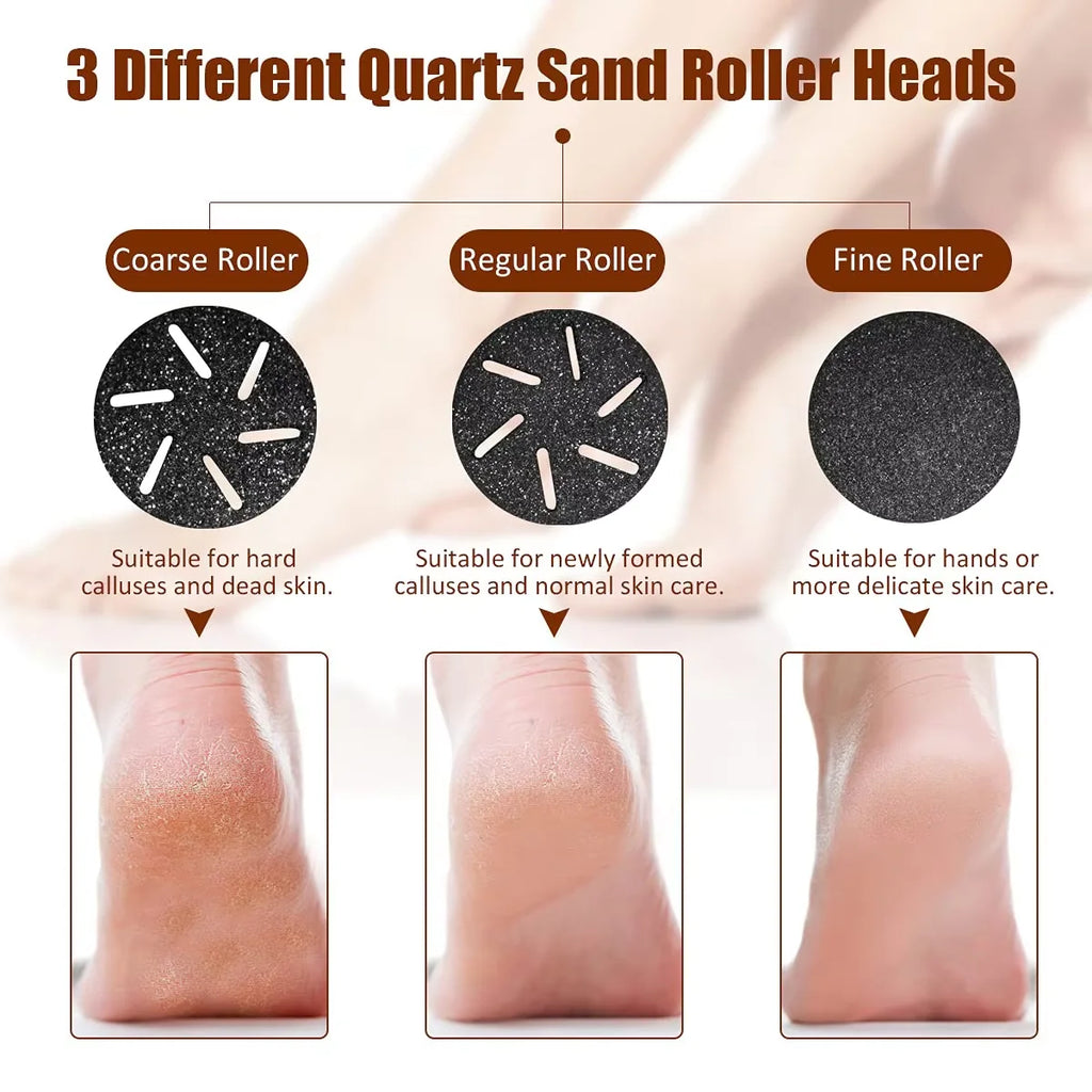 SoftStep Pro® – Electric Foot File
